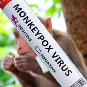 Новый случай оспы обезьян выявлен в России